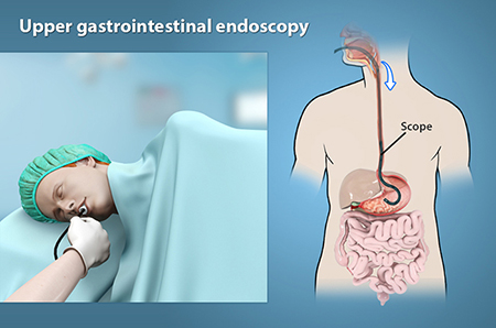 endoscopy colonoscopy gastroscopy procedure upper doctor gastrointestinal endoscope performed trained known well also who au